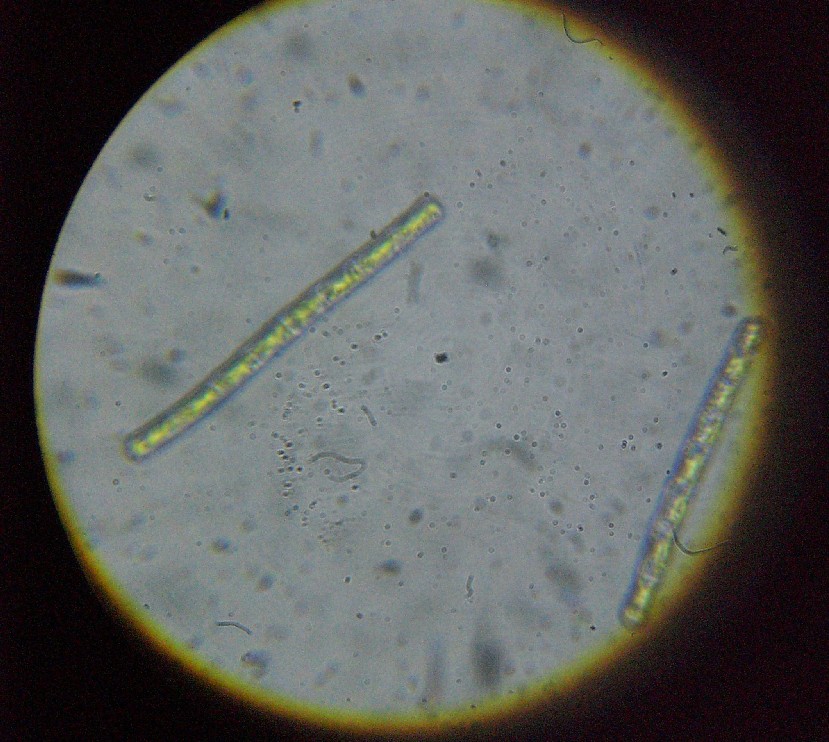 Adattare una digitale al microscopio?